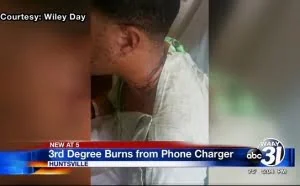 [视频]iPhone充电器漏电：阿拉巴马一男子不幸被三度烧伤