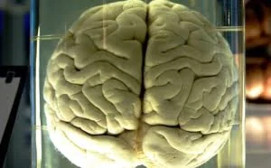 科学家：脑植入物可以将记忆力提高30%