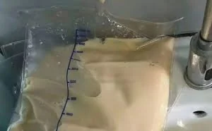 27岁姑娘一日三餐全靠点外卖 血浆成了“猪油色”