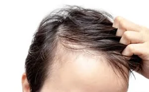 变白的头发能重新变黑吗？医生说了一番话！